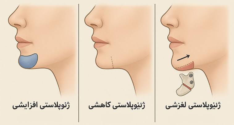 مراحل گرفتن هزینه جراحی فک از بیمه تکمیلی